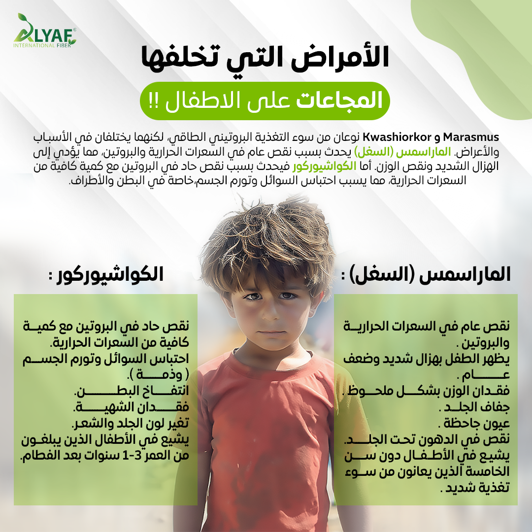 الأمراض التي تخلفها المجاعات على الاطفال