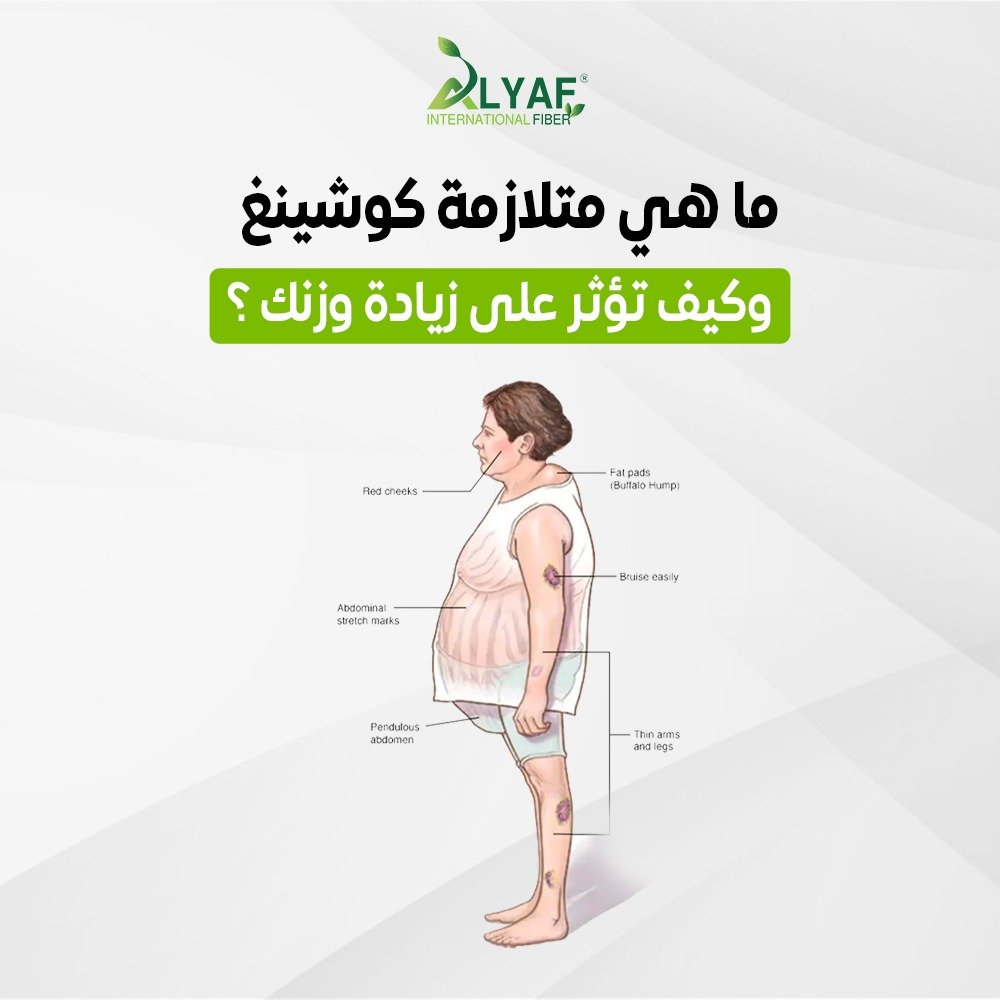 ما هي متلازمة كوشينغ وكيف تؤثر على زيادة وزنك ؟