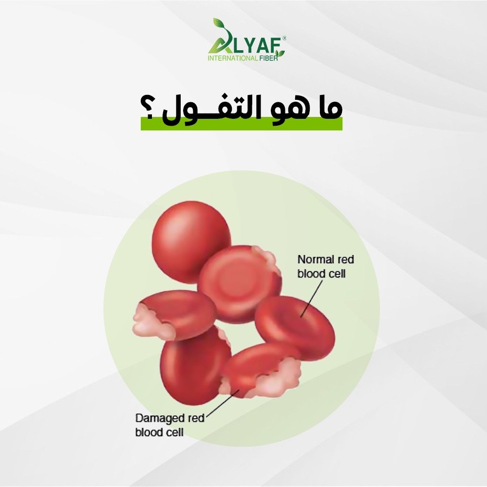 ما هو التفول؟ وما الإجراءات التغذوية لتقليل الأعراض وتحسين الهضم؟